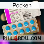 Poxet new07